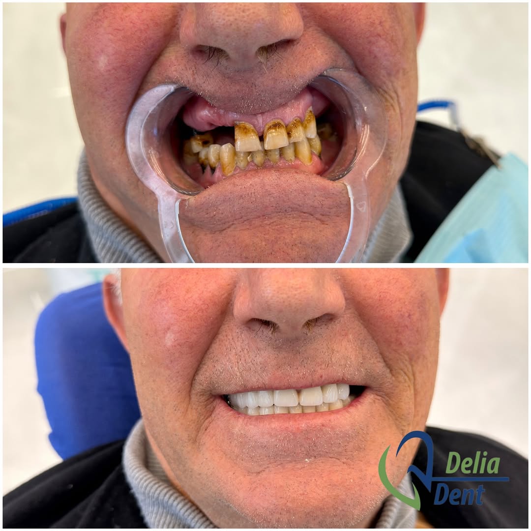 Kujdes dentar i përshtatur për ju në Lezhë